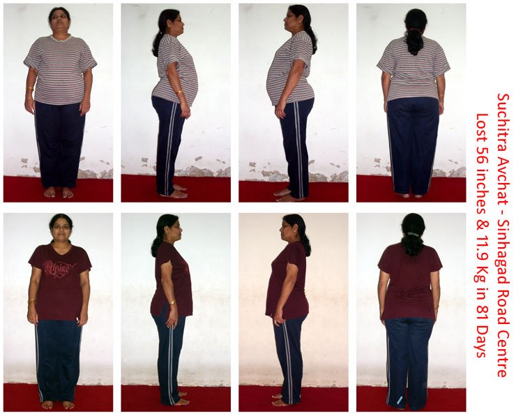 Vrushali S Slimming Centre Before After