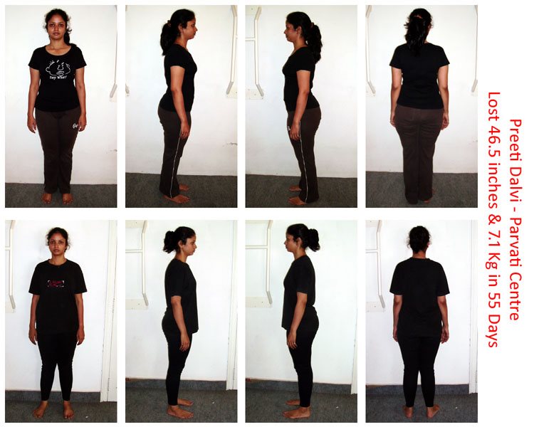 Vrushali S Slimming Centre Before After